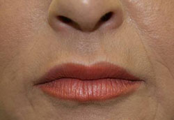 lipsafter.jpg